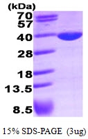 AR09387PU-L - LDHA