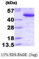 AR09394PU-L - CTBP1