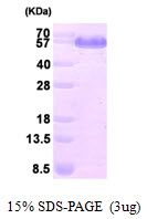 AR09404PU-L - Dihydrolipoyl dehydrogenase