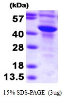 AR09409PU-L - SULT2B1