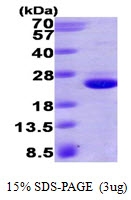 AR09416PU-L - HRAS