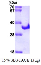 AR09419PU-L - HCV NS3