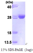 AR09429PU-L - UBE2T