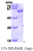 AR09432PU-L - SQSTM1