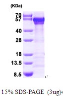 AR09452PU-L - Calreticulin
