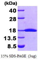 AR09473PU-L - FHIT