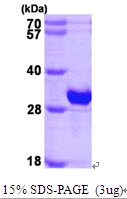 AR09521PU-L - Beta-crystallin B1
