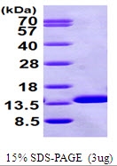 AR09561PU-N - Beta-2-microglobulin