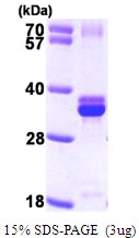 AR09570PU-L - NUDT5