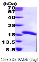 AR09579PU-L - UBE2V2