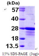 AR09605PU-L - CBFB