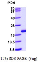 AR09619PU-L - Glia maturation factor beta / GMFB