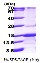 AR09630PU-L - Rab-interacting factor (RABIF)