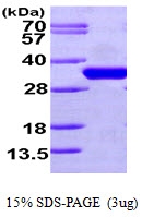 AR09648PU-L - CDC34