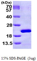 AR09651PU-L - EIF1AX
