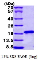 AR09685PU-L - NCBP2