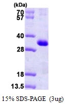 AR09729PU-L - Calsenilin