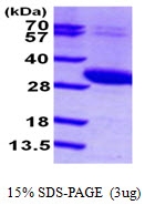 AR09744PU-L - UCK2