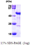 AR09799PU-N - DNAJB6