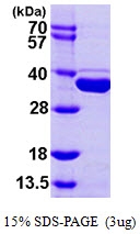 AR09809PU-L - METTL1