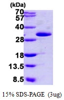 AR09826PU-L - Grancalcin