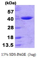 AR09882PU-L - Beta-lactamase