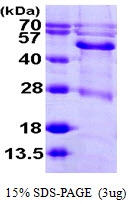 AR09884PU-N - BCKDHA