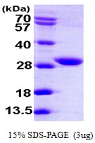 AR09888PU-L - KDS reductase