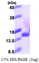 AR09903PU-L - EIF1B