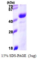 AR09925PU-N - DNAJB11