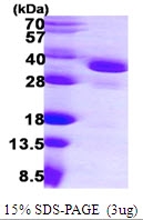 AR09964PU-N - EIF2B1 / EIF2BA