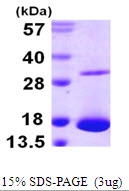 AR09974PU-L - Galectin-10