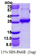 AR39045PU-L - RAB3A