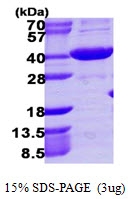 AR39046PU-L - AKR1C4