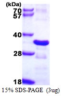 AR39055PU-L - CHMP2B