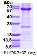 AR39094PU-L - HDAC2