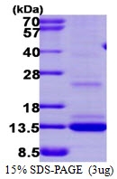 AR39140PU-L - Matrix Gla Protein