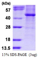 AR50154PU-N - HDAC8