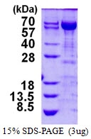 AR50271PU-N - Transketolase (TKT)