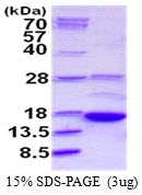 AR50351PU-N - AKAP7 alpha/beta
