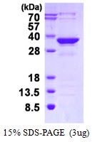 AR50398PU-N - MMACHC
