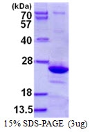 AR50456PU-N - Endomucin
