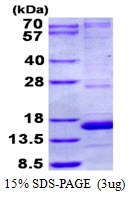 AR50586PU-N - NDUFA5