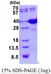 AR50608PU-N - Galectin-4