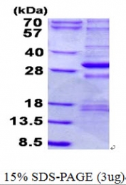 AR50609PU-N - Complex I subunit NDUFS3