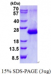 AR50653PU-N - Amelotin