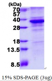 AR50659PU-N - CDK5