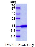 AR50692PU-N - CDK2AP2