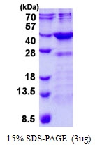 AR50708PU-N - Fructosamine-3-kinase