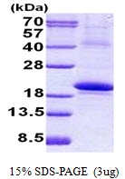AR50764PU-N - IL18BP